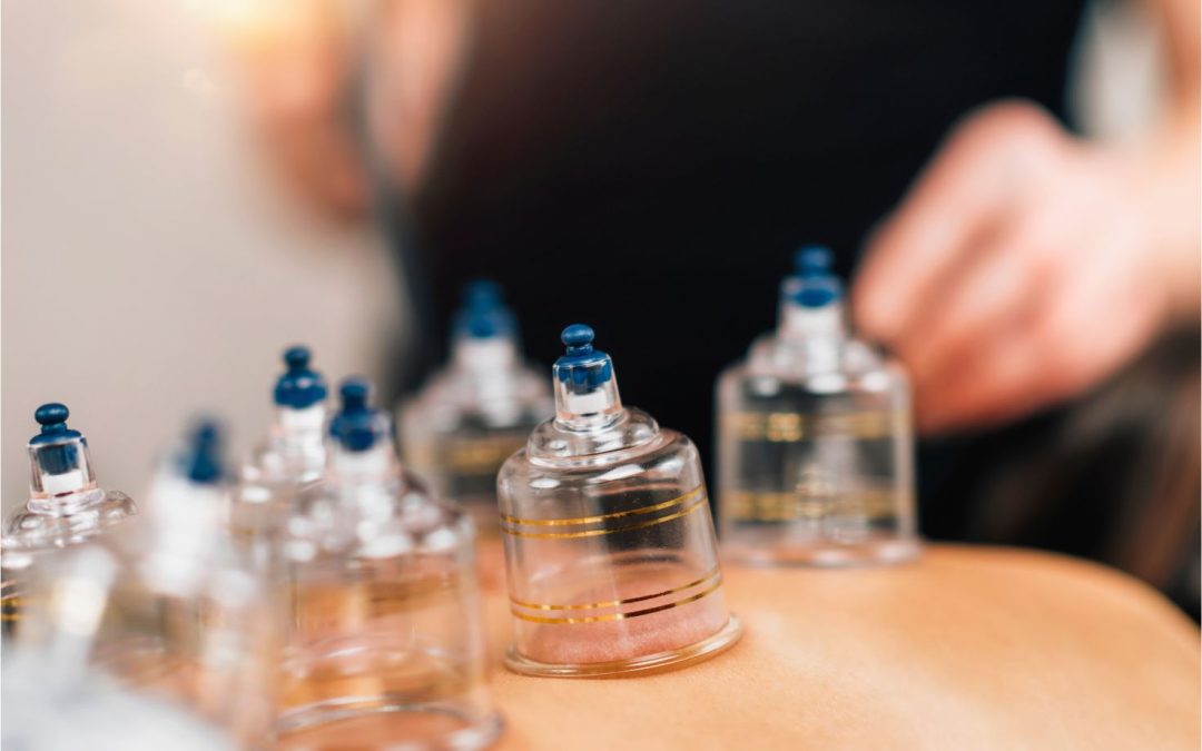 Schröpfen bei Kindern – Methode und Anwendung
