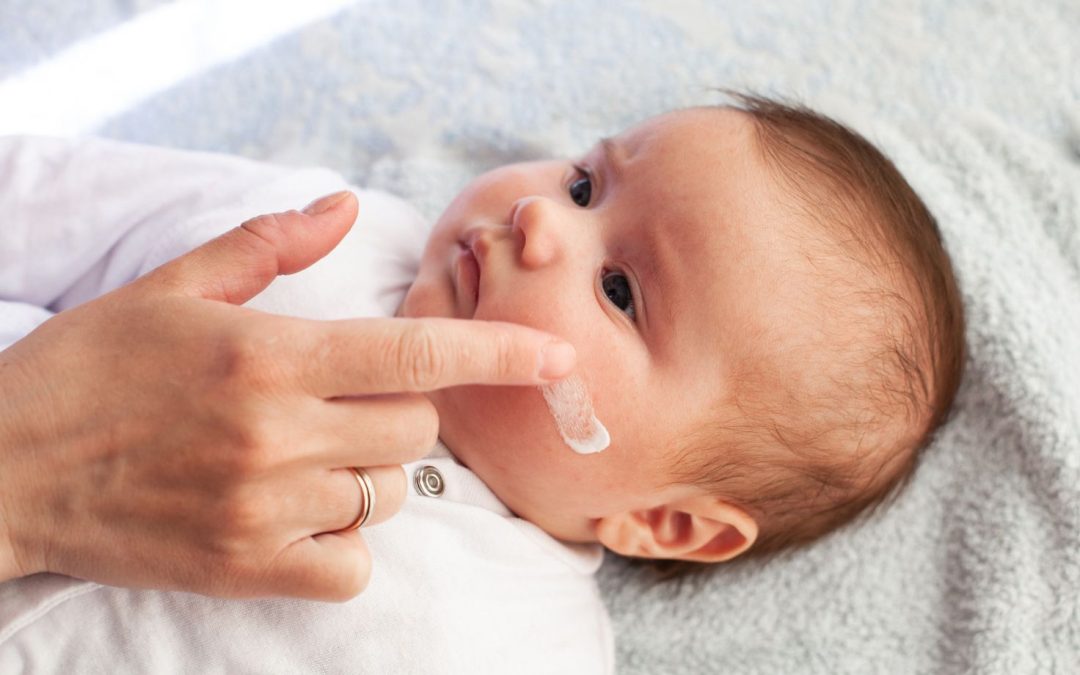 Neurodermitis bei Kindern – Behandlung ohne Medikamente